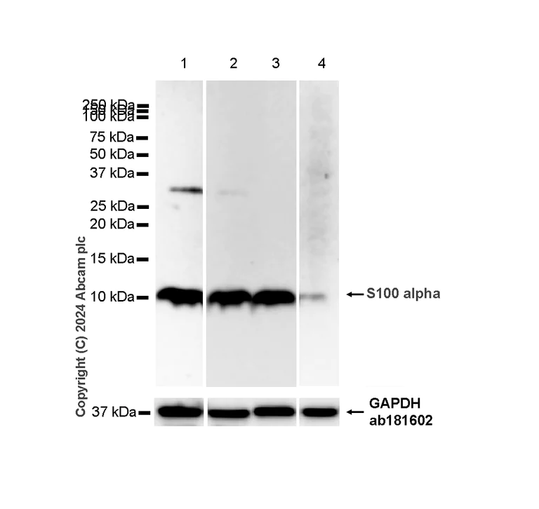Western blot - Anti-S100 alpha antibody [RM1154] - BSA and Azide free (AB317635)