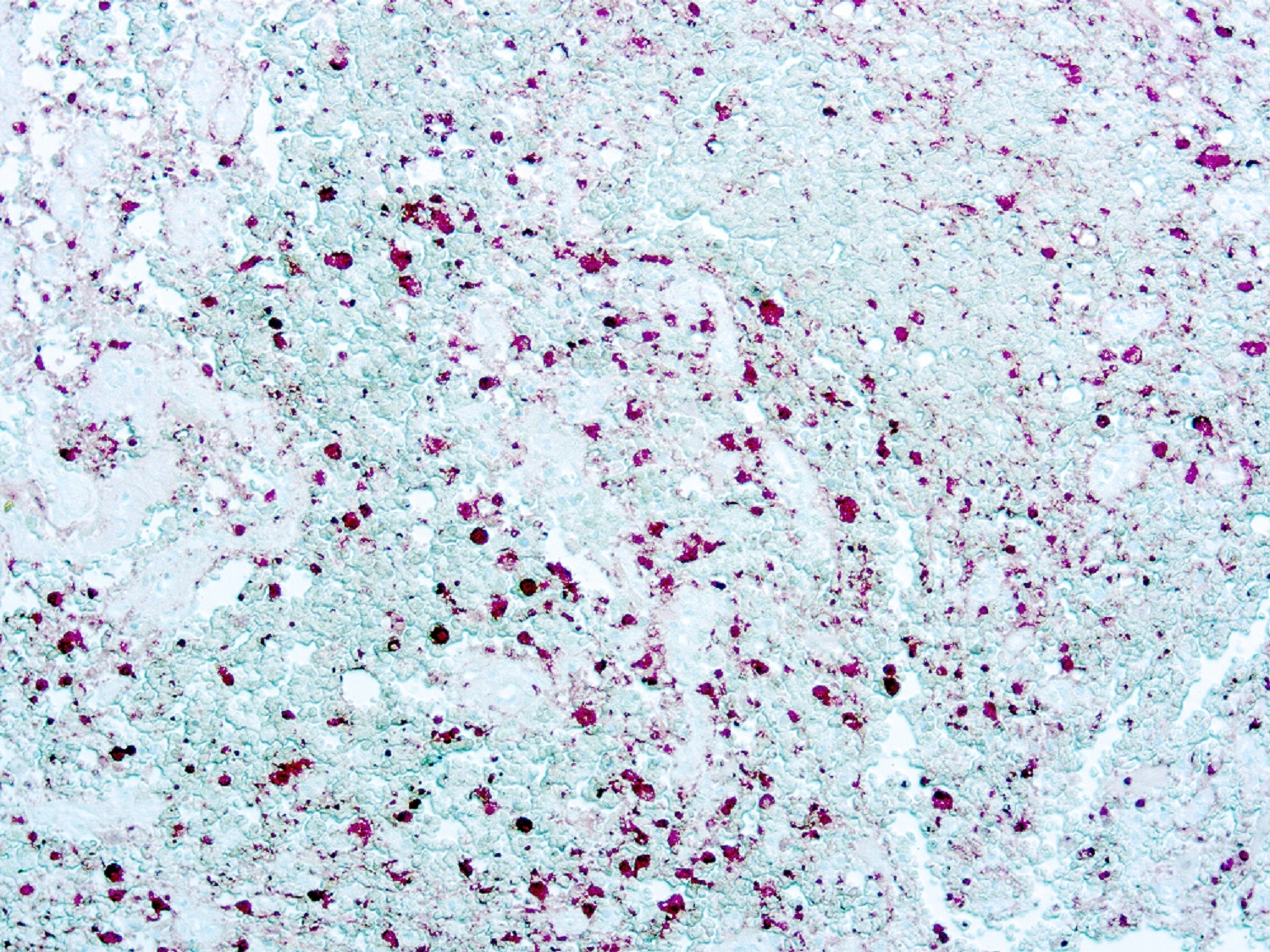 Immunohistochemistry (Formalin/PFA-fixed paraffin-embedded sections) - Anti-S100 antibody [4C4.9] (AB4066), expandable thumbnail