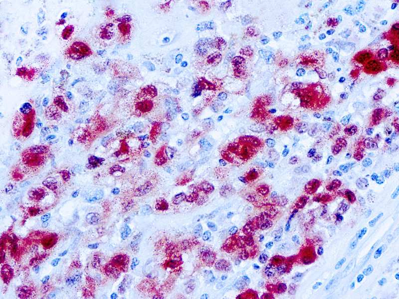 Immunohistochemistry (Formalin/PFA-fixed paraffin-embedded sections) - Anti-S100 antibody [4C4.9] (AB4066), expandable thumbnail