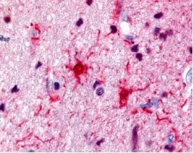Immunohistochemistry (Formalin/PFA-fixed paraffin-embedded sections) - Anti-S100 antibody (AB34686)