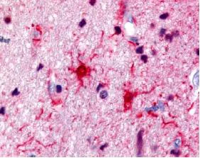Immunohistochemistry (Formalin/PFA-fixed paraffin-embedded sections) - Anti-S100 antibody (AB34686)