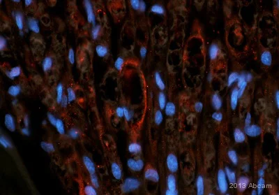 Immunohistochemistry (Formalin/PFA-fixed paraffin-embedded sections) - Anti-S100 antibody (AB34686)