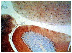 Immunohistochemistry (Formalin/PFA-fixed paraffin-embedded sections) - Anti-S100 antibody (AB34686)