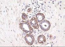Immunohistochemistry (Formalin/PFA-fixed paraffin-embedded sections) - Anti-S100 antibody [D28-E] (AB136629)