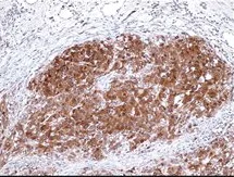 Immunohistochemistry (Formalin/PFA-fixed paraffin-embedded sections) - Anti-S100 antibody [D28-E] (AB136629)