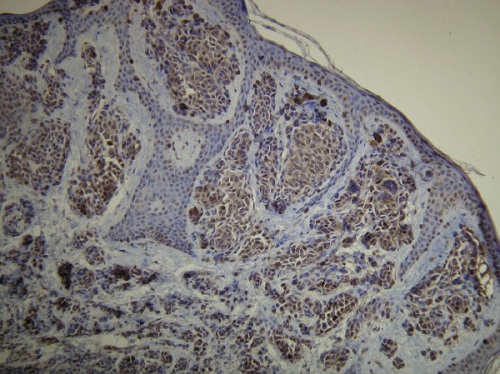Immunohistochemistry (Formalin/PFA-fixed paraffin-embedded sections) - Anti-S100 antibody [D28-E] (AB136629)