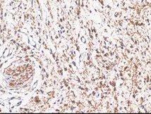 Immunohistochemistry (Formalin/PFA-fixed paraffin-embedded sections) - Anti-S100 antibody [D28-E] (AB136629)