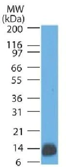 Western blot - Anti-S100 beta antibody [4C4.9] - Astrocyte Marker (AB218513)