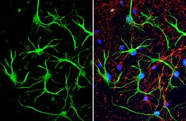 Immunocytochemistry/ Immunofluorescence - Anti-S100 beta antibody - Astrocyte Marker (AB227914)