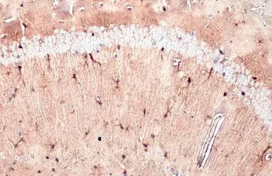 Immunohistochemistry (Formalin/PFA-fixed paraffin-embedded sections) - Anti-S100 beta antibody - Astrocyte Marker (AB227914)