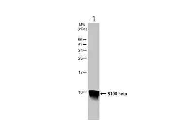 Western blot - Anti-S100 beta antibody - Astrocyte Marker (AB227914)