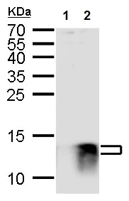 Western blot - Anti-S100 beta antibody - Astrocyte Marker (AB227914)