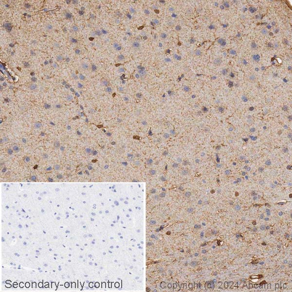Immunohistochemistry (Formalin/PFA-fixed paraffin-embedded sections) - Anti-S100 beta antibody (AB41548), expandable thumbnail