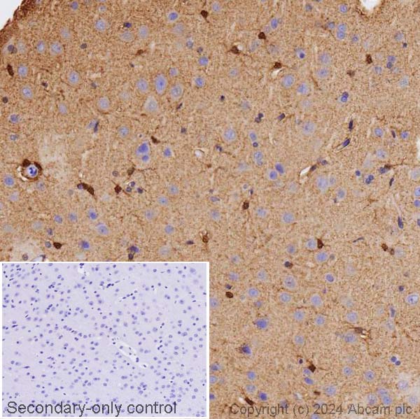 Immunohistochemistry (Formalin/PFA-fixed paraffin-embedded sections) - Anti-S100 beta antibody (AB41548), expandable thumbnail