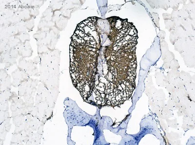 Immunohistochemistry (Formalin/PFA-fixed paraffin-embedded sections) - Anti-S100 beta antibody - Astrocyte Marker (AB41548)