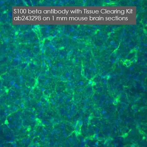 Immunohistochemistry (Formalin/PFA-fixed paraffin-embedded sections) - Anti-S100 beta antibody [EP1576Y] - Astrocyte Marker (AB52642)
