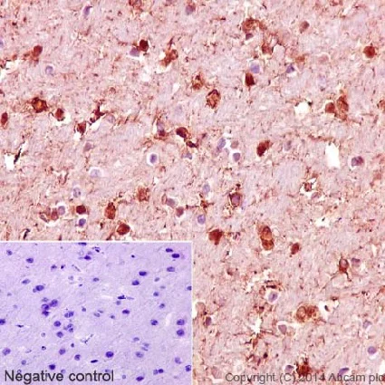 Immunohistochemistry (Formalin/PFA-fixed paraffin-embedded sections) - Anti-S100 beta antibody [EP1576Y] - Astrocyte Marker (AB52642)
