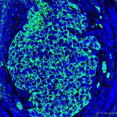 Immunohistochemistry (Formalin/PFA-fixed paraffin-embedded sections) - Anti-S100 beta antibody [EP1576Y] - Astrocyte Marker (AB52642)