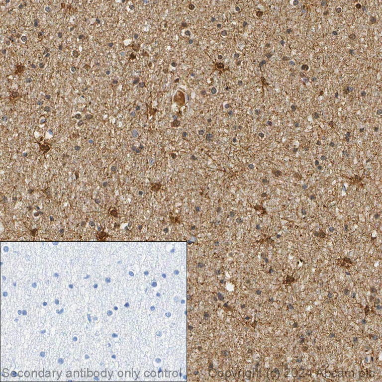 Immunohistochemistry (Formalin/PFA-fixed paraffin-embedded sections) - Anti-S100 beta antibody [EP1576Y] - Astrocyte Marker (AB52642)