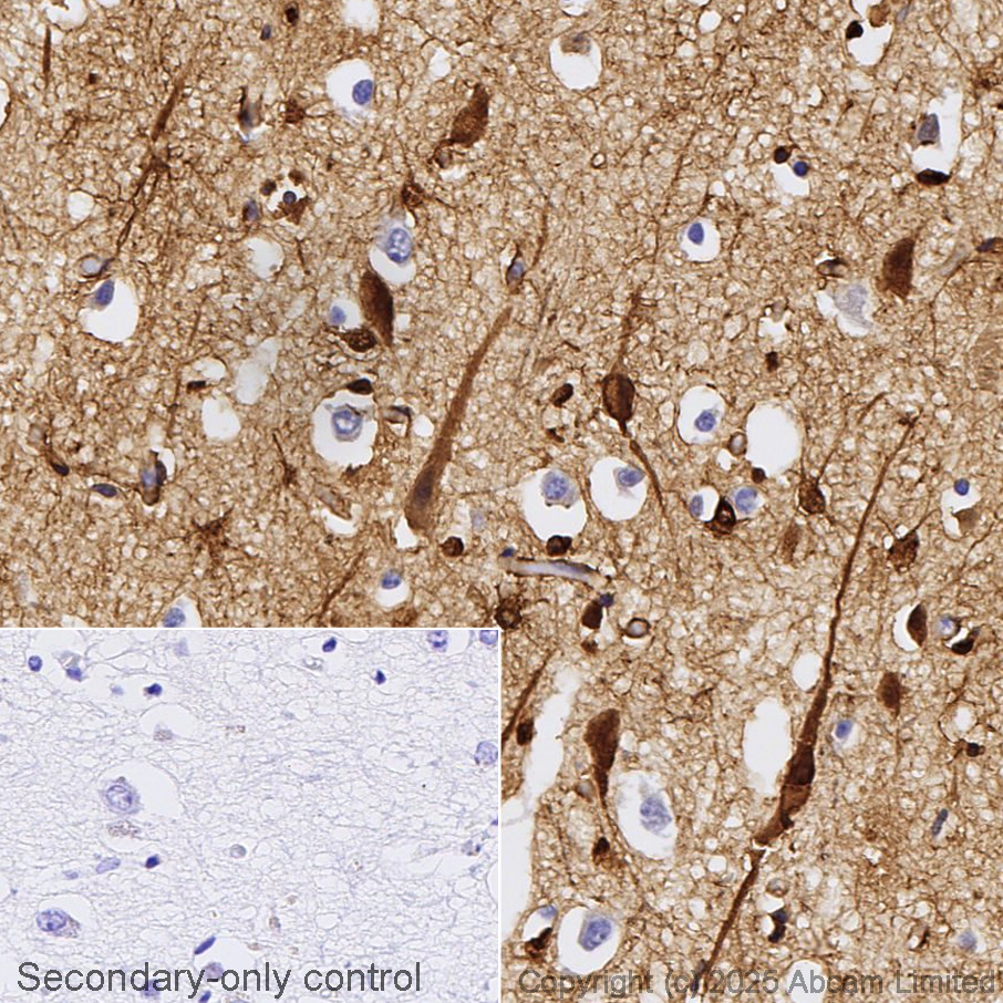 Anti-S100 beta antibody [EP1576Y] - Astrocyte Marker