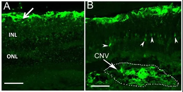 Immunohistochemistry (Formalin/PFA-fixed paraffin-embedded sections) - Anti-S100 beta antibody [EP1576Y] - Astrocyte Marker (AB52642)