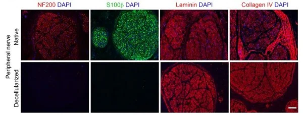Immunohistochemistry (Formalin/PFA-fixed paraffin-embedded sections) - Anti-S100 beta antibody [EP1576Y] - Astrocyte Marker (AB52642)
