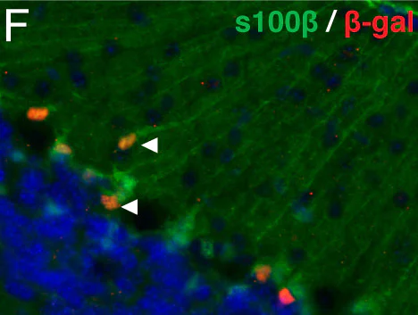 Immunohistochemistry (Formalin/PFA-fixed paraffin-embedded sections) - Anti-S100 beta antibody [EP1576Y] - Astrocyte Marker (AB52642)