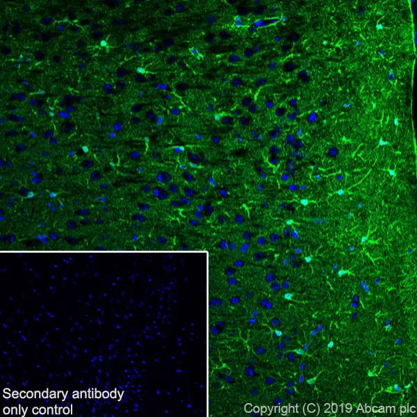 Immunohistochemistry (Frozen sections) - Anti-S100 beta antibody [EP1576Y] - Astrocyte Marker (AB52642)