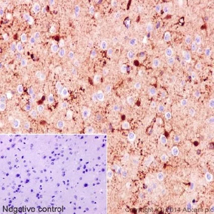 Immunohistochemistry (Formalin/PFA-fixed paraffin-embedded sections) - Anti-S100 beta antibody [EP1576Y] - BSA and Azide free (AB215989)