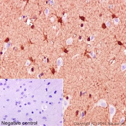 Immunohistochemistry (Formalin/PFA-fixed paraffin-embedded sections) - Anti-S100 beta antibody [EP1576Y] - BSA and Azide free (AB215989)
