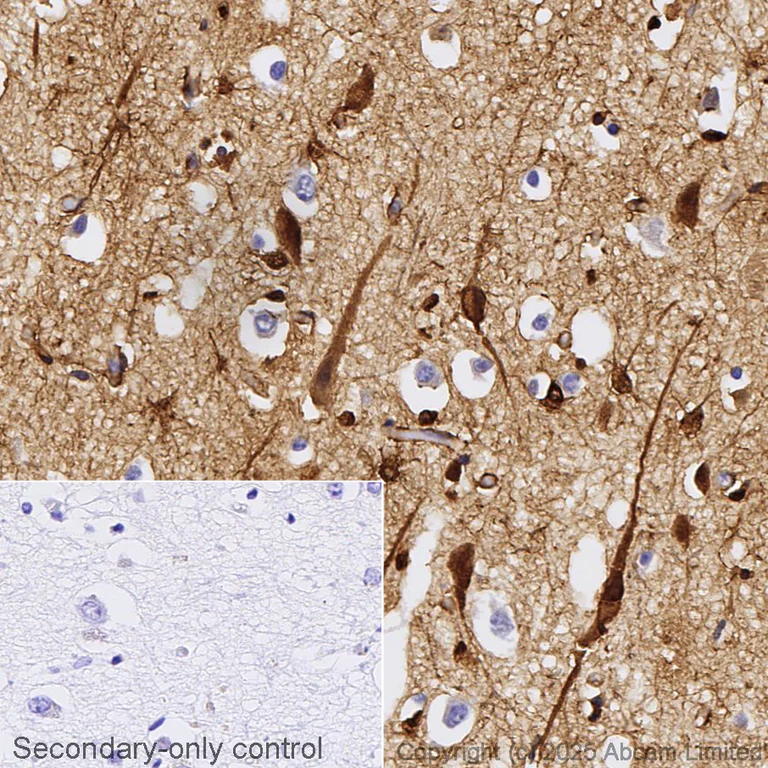 Immunohistochemistry (Formalin/PFA-fixed paraffin-embedded sections) - Anti-S100 beta antibody [EP1576Y] - BSA and Azide free (AB215989)