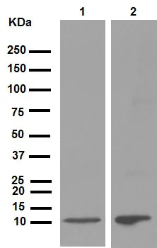 Western blot - Anti-S100 beta antibody [EP1576Y] - BSA and Azide free (AB215989)