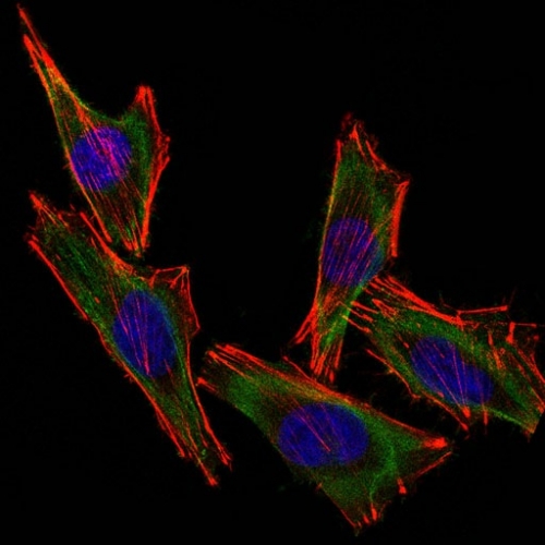 Immunocytochemistry - Anti-S100 beta antibody [S100B/1012] (AB218515), expandable thumbnail
