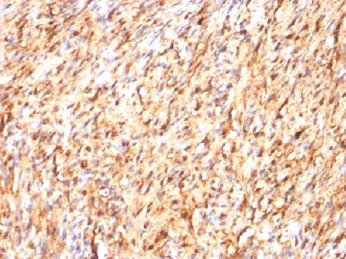 Immunohistochemistry (Formalin/PFA-fixed paraffin-embedded sections) - Anti-S100 beta antibody [S100B/1012] (AB218515), expandable thumbnail