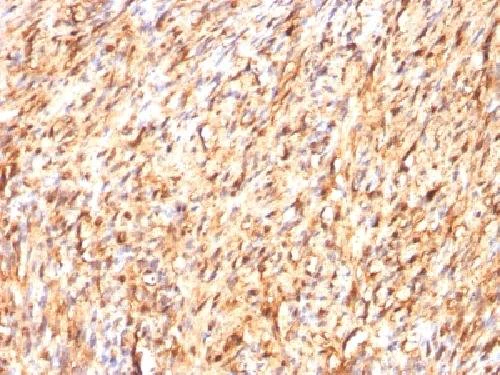 Immunohistochemistry (Formalin/PFA-fixed paraffin-embedded sections) - Anti-S100 beta antibody [S100B/1012] - Astrocyte Marker (AB218515)