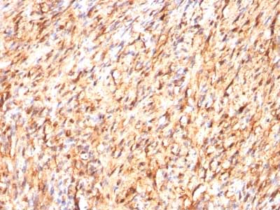Immunohistochemistry (Formalin/PFA-fixed paraffin-embedded sections) - Anti-S100 beta antibody [S100B/1012] - BSA and Azide free (AB218956), expandable thumbnail