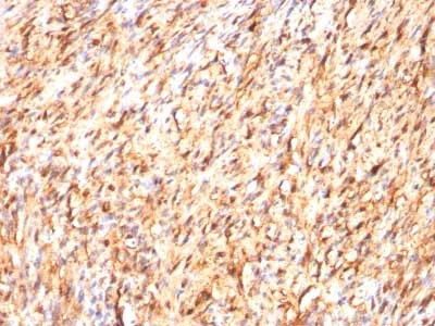 Immunohistochemistry (Formalin/PFA-fixed paraffin-embedded sections) - Anti-S100 beta antibody [S100B/1012] - BSA and Azide free (AB218956)