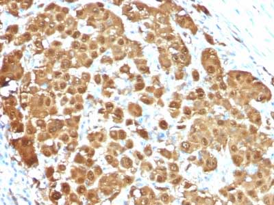 Immunohistochemistry (Formalin/PFA-fixed paraffin-embedded sections) - Anti-S100 beta antibody [S100B/1012] - BSA and Azide free (AB218956), expandable thumbnail