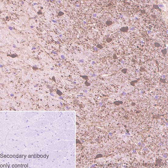 Immunohistochemistry (Formalin/PFA-fixed paraffin-embedded sections) - Anti-S100 beta antibody [SP127] - Astrocyte Marker (AB115803), expandable thumbnail