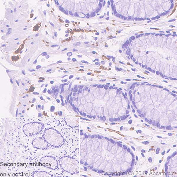 Immunohistochemistry (Formalin/PFA-fixed paraffin-embedded sections) - Anti-S100 beta antibody [SP127] - Astrocyte Marker (AB115803), expandable thumbnail