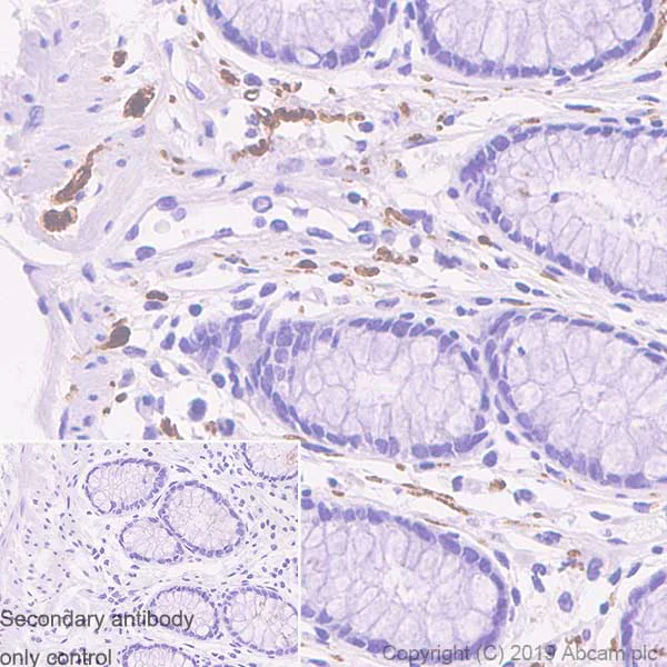 Immunohistochemistry (Formalin/PFA-fixed paraffin-embedded sections) - Anti-S100 beta antibody [SP127] - Astrocyte Marker (AB115803)
