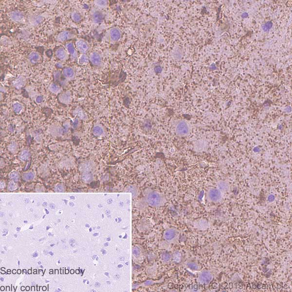 Immunohistochemistry (Formalin/PFA-fixed paraffin-embedded sections) - Anti-S100 beta antibody [SP127] (AB115803), expandable thumbnail