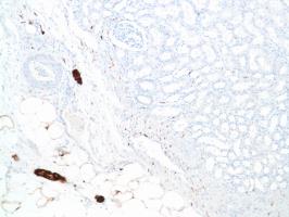 Immunohistochemistry (Formalin/PFA-fixed paraffin-embedded sections) - Anti-S100 beta antibody [SP127] (ab115803), expandable thumbnail