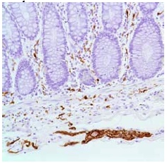 Immunohistochemistry (Formalin/PFA-fixed paraffin-embedded sections) - Anti-S100 beta antibody [SP127] (ab115803), expandable thumbnail