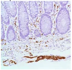 Immunohistochemistry (Formalin/PFA-fixed paraffin-embedded sections) - Anti-S100 beta antibody [SP127] - Astrocyte Marker (AB115803)