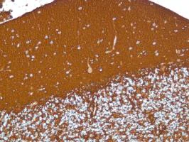 Immunohistochemistry (Formalin/PFA-fixed paraffin-embedded sections) - Anti-S100 beta antibody [SP127] - Astrocyte Marker (AB115803)