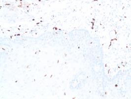 Immunohistochemistry (Formalin/PFA-fixed paraffin-embedded sections) - Anti-S100 beta antibody [SP127] (ab115803), expandable thumbnail