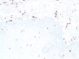 Immunohistochemistry (Formalin/PFA-fixed paraffin-embedded sections) - Anti-S100 beta antibody [SP127] - Astrocyte Marker (AB115803)