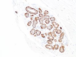 Immunohistochemistry (Formalin/PFA-fixed paraffin-embedded sections) - Anti-S100 beta antibody [SP127] (ab115803), expandable thumbnail
