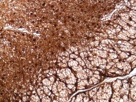 Immunohistochemistry (Formalin/PFA-fixed paraffin-embedded sections) - Anti-S100 beta antibody [SP127] (ab115803), expandable thumbnail